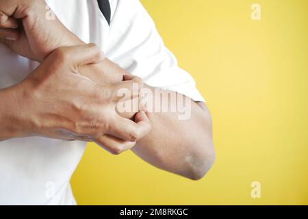 Mann, der an juckender Haut leidet, Nahaufnahme. Stockfoto
