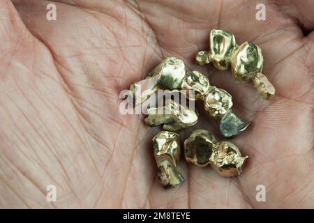 Ein Fall für die zahnärztliche Zusatzversicherung. Eine gebrochene Prothese liegt in einer Hand. Stockfoto