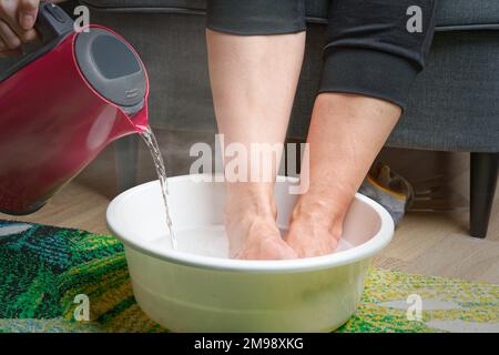 Fußnässe. Die Frau hat ihr heißes Wasser für die Füße gegeben. Hausgemachtes Bad für trockene Füße Haut. Stockfoto