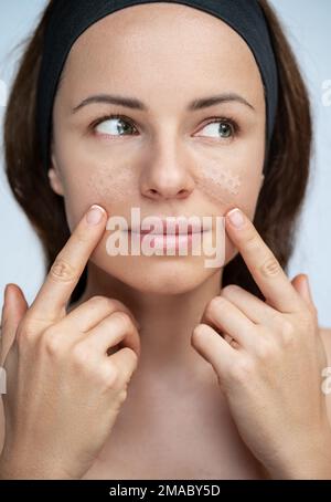 Junge Erwachsene Frau, die ein Kinesio-Gesichtsband auf ihr Gesicht aufklebt, Falten im Gesicht kleben. Stockfoto