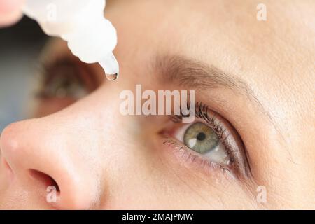 Nahaufnahme einer Frau, die Augentropfen aufträgt. Stockfoto
