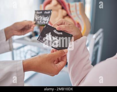 Arzt, Hände und Frau mit Ultraschallfoto für Wachstum, Entwicklung oder Familienplanung in der Klinik. Eine schwarze Ärztin, ein Ultraschallbild oder Stockfoto