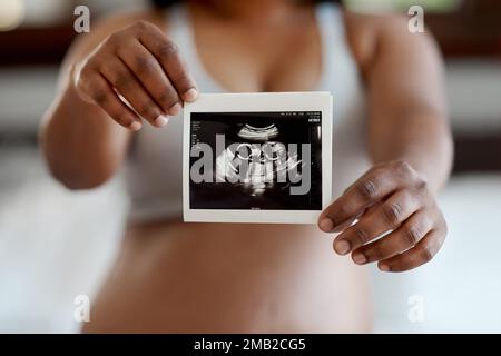 Der erste von vielen Baby-Schnappschüssen. Nahaufnahme einer unbekannten Frau, die zu Hause ein Ultraschallbild hält. Stockfoto