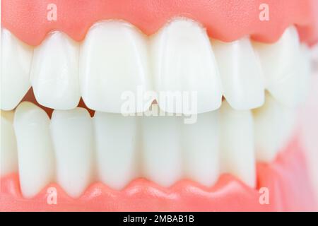 Frontansicht der Totalprothese. Zahnärztliches Konzept. Falsche Zähne, Kiefer. Zahnärztliches Konzeptfoto. Prothetische Zahnheilkunde. Falsche Zähne. Angedeuteter Zahn oder Zahn Stockfoto