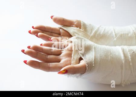 Zwei weibliche Hände mit gebrochenen Handgelenken, nachdem sie von einem Fahrrad in einem Cast auf einem isolierten Hintergrund gefallen waren, die Hände in einem Cast Stockfoto