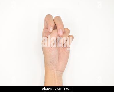 Zerebrale Lähmungshand bei südostasiatischem jungen männlichen Patienten. Typischerweise bei Hemiplegie und Quadriplegie. Handgelenkbeugung mit ulnärer Deposition. Stockfoto