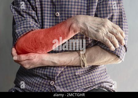 Schmerzen im Oberarm einer südostasiatischen Alten. Konzept von Ellenbogen- und Unterarmschmerzen, Verletzungen oder Muskelproblemen. Stockfoto