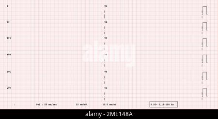 Rotes, leeres ekg-Papier, nahtloses, gemustertes Papier zur Aufzeichnung der Herzfrequenz Stockfoto
