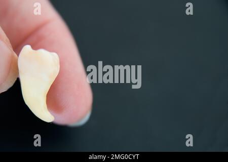 Eine weiße menschliche Hand hält einen Wangenzahn. Schwarzer Hintergrund Stockfoto