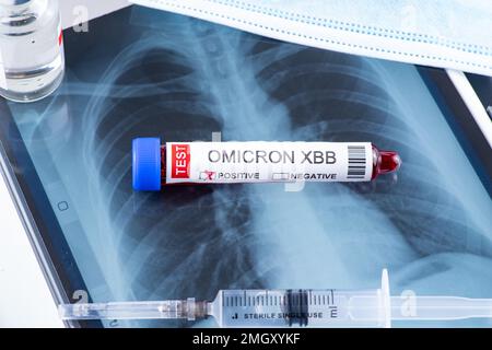 Reagenzglas mit der Kennzeichnung „OMICRON XBB Variant Test positive“ Stockfoto