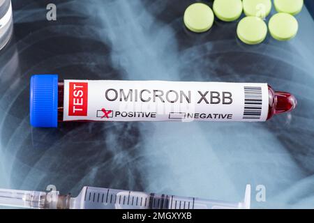 Reagenzglas mit der Kennzeichnung „OMICRON XBB Variant Test positive“ Stockfoto