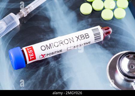 Reagenzglas mit der Kennzeichnung „OMICRON XBB Variant Test positive“ Stockfoto