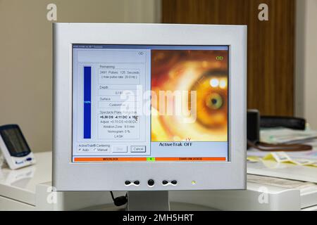 Laser-Sehkorrektur. Patient und Team von Chirurgen im Operationssaal während der Ophthalmochirurgie. Lidspekulum. LASIK-Behandlung. Patient unter Stockfoto
