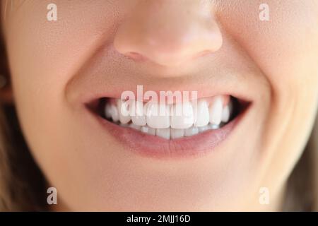 Nahaufnahme einer Frau mit gesunden, glatten weißen Zähnen. Stockfoto