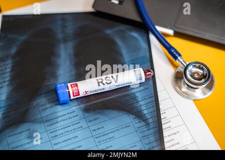 Blutentnahmeröhrchen Respiratory Syncytial Virus(RSV) Test positive Ergebnisse,medizinisches Konzept Stockfoto