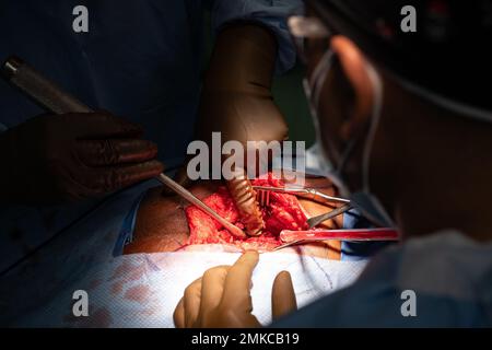 Ein lokaler guatemaltekischer orthopädischer Chirurg, der dem Hospital Regional de Occidente in Quetzaltenango, Guatemala, zugewiesen ist, führt am 30. August 2022 eine Operation an einem Patienten während des Health Engagements Assistance Response Team 2022 (HEART 22) durch. HEART 22 ist eine von der Joint Task Force-Bravo geleitete Mission, die die Menschen in Honduras und Guatemala medizinisch versorgt. Während HEART 22 operierten das US-Militär und die medizinischen Fachkräfte der Partnerstaaten Seite an Seite in drei Fachgebieten: Ophthalmologie (allgemeine und Hornhauttransplantationen), Orthopädie (allgemeine und traumatologische Operationen) und Zahnmedizin (restaurative Operationen) Stockfoto