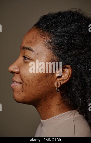 Nahaufnahme des Profils einer lächelnden schwarzen Frau mit Aknenarben im Gesicht Stockfoto