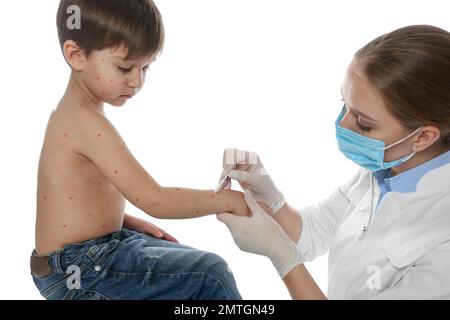 Arzt, der Creme auf die Haut eines kleinen Jungen mit Windpocken vor weißem Hintergrund aufträgt. Varicella-Zoster-Virus Stockfoto