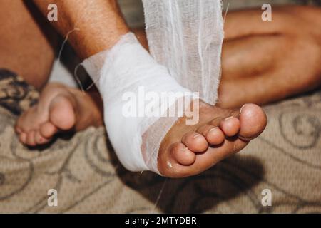 Der Prozess der Selbstbandage des Beines nach Operationen. Verbandsverletzungen zu Hause Stockfoto