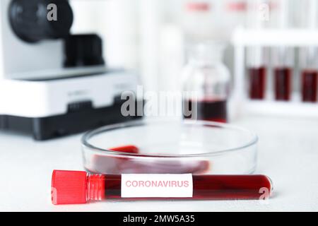 Reagenzglas mit Blutprobe und Kennzeichnung CORONA VIRUS und Petrischale auf dem Tisch im Labor, Closeup Stockfoto