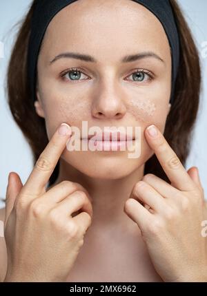 Schönheitsbegriff-Frau mit kinesiologischen elastischen Gesichtsbändern. Stockfoto