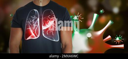 Mann mit kranker Lunge umgeben von Viren auf dunklem Hintergrund Stockfoto