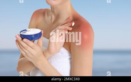 Eine Frau mit Sonnenbrand in der Nähe des Meeres, Nahaufnahme. Hautschutz vor Sonneneinstrahlung im Sommer Stockfoto