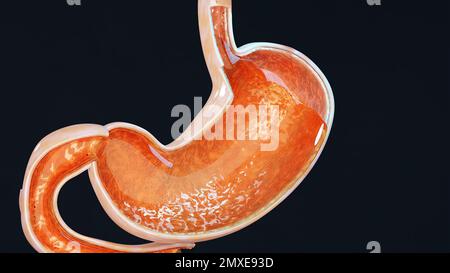 Magensäure Relux. Speiseröhre, gerd. Schmerzen im Verdauungssystem, Gastritis, Pyrose, menschliches Körperorgan, 3D-Rendering Stockfoto