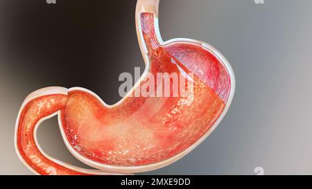 Magensäure Relux. Speiseröhre, gerd. Schmerzen im Verdauungssystem, Gastritis, Pyrose, menschliches Körperorgan, 3D-Rendering Stockfoto