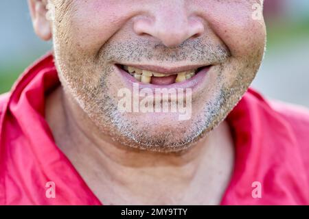 Zahnloses Lächeln eines alten unrasierten Mannes aus Osteuropa. Stockfoto