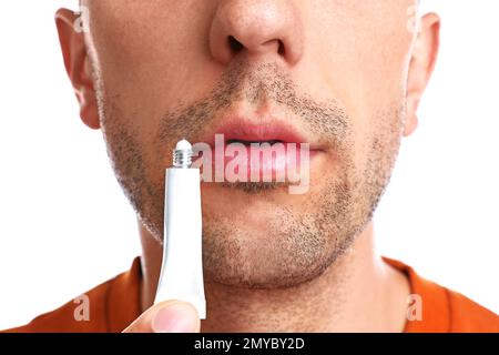 Junger Mann mit Fieberbläschen, der Creme auf die Lippen aufträgt, vor weißem Hintergrund, Nahaufnahme Stockfoto