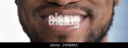 Ein glücklicher Afrikaner, der mit einem Zahnlächeln posiert und weiße Zähne zeigt Stockfoto