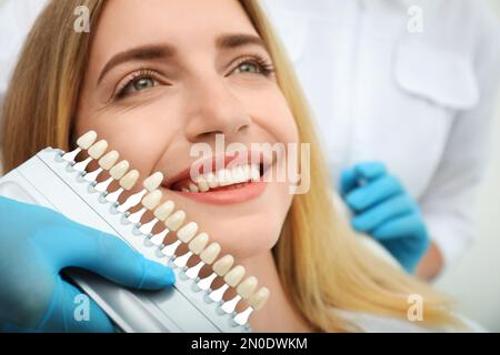 Arzt, der die Zahnfarbe des Patienten mit der Palette, Nahaufnahme, zusammenpasst. Kosmetische Zahnheilkunde Stockfoto