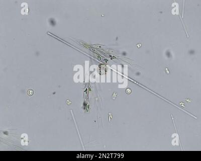 Kieselalgen, Algen unter mikroskopischer Sicht, Phytoplankton, Fossilien, Kieselsäure, goldgelbe Algen Stockfoto