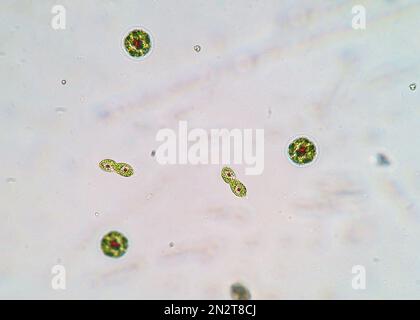 Haematococcus pluvialis-Grün- und Zystenalgen unter mikroskopischer Sicht - Hämatozyste, aktive und ruhende Zellen, sich teilende Zellen, Mitose, starkes Antioxida Stockfoto