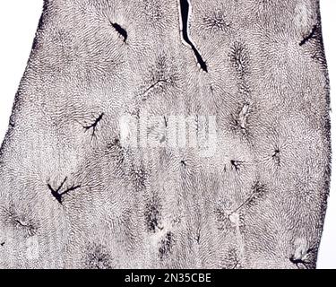 Die Untersuchung eines Organmikrogefäßes beinhaltet in der Regel das Füllen von Blutgefäßen mit einem unter dem Mikroskop sichtbaren Etikett. Mikrocontroller mit geringer Vergrößerung Stockfoto