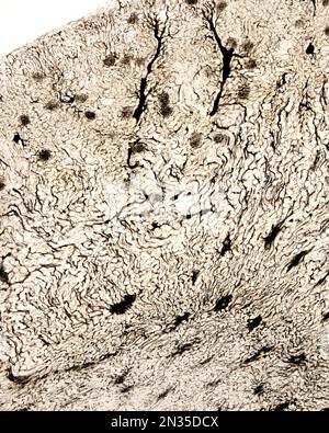 Die Untersuchung eines Organmikrogefäßes beinhaltet in der Regel das Füllen von Blutgefäßen mit einem unter dem Mikroskop sichtbaren Etikett. Lichtmikroskop mikrog Stockfoto