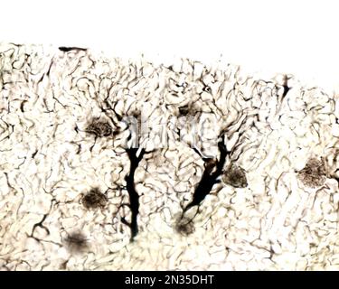 Die Untersuchung eines Organmikrogefäßes beinhaltet in der Regel das Füllen von Blutgefäßen mit einem unter dem Mikroskop sichtbaren Etikett. Lichtmikroskop mikrog Stockfoto