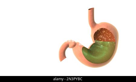 Saurer Reflux im menschlichen Magen 3D-Darstellung Stockfoto