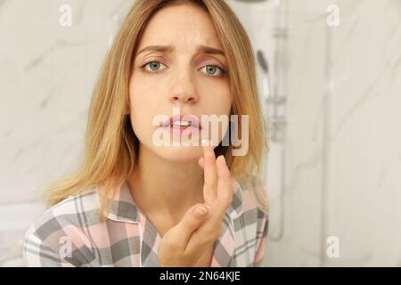 Eine Frau mit Herpes, die Creme auf die Lippe aufträgt Stockfoto