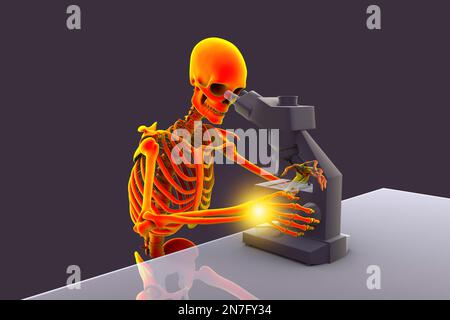 Karpaltunnelsyndrom bei Laborarbeitern, Illustration Stockfoto