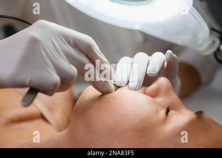 Kosmetikerin in Handschuhen arbeitet an weiblichem Kundengesicht mit Spritze Nahaufnahme, Elektrolyse Gesichtshaarentfernung, Schönheitsbehandlungen Stockfoto