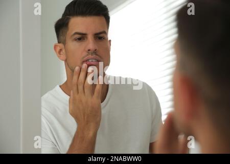 Mann mit Herpes, der zu Hause Lippen vor dem Spiegel berührt Stockfoto