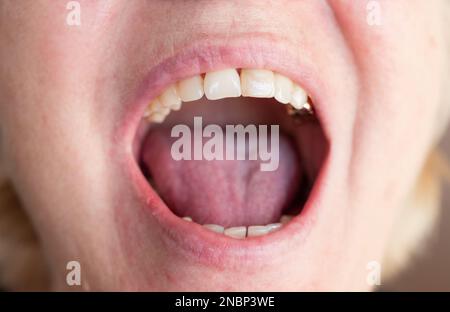 Nahaufnahme von natürlich aussehenden Zähnen einer alten Frau. Stockfoto