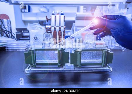 Die Western-Blot-Analyse als Proteinanalyse zum Proteinnachweis. Diese Technik wird in medizinischen oder Forschungslabors verwendet. Außerdem erkennt die Methode HIV Stockfoto