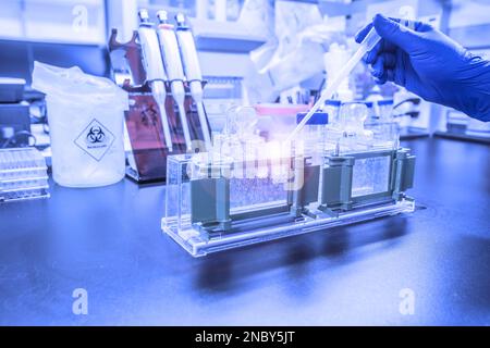 Die Western-Blot-Analyse als Proteinanalyse zum Proteinnachweis. Diese Technik wird in medizinischen oder Forschungslabors verwendet. Außerdem erkennt die Methode HIV Stockfoto