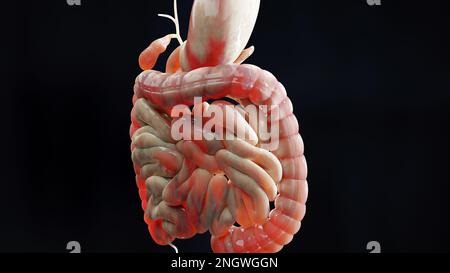 Mann mit Crohns-Krankheit, männliche Anatomie, entzündeter Dickdarm, Sigmoid Colon, Teile des menschlichen Verdauungssystems, 3D-Rendern Stockfoto