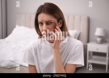 Frau mit Gesichtsverletzungen im Schlafzimmer. Opfer häuslicher Gewalt Stockfoto