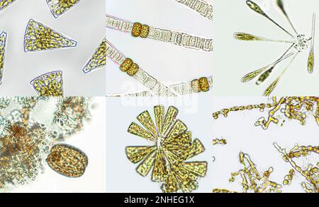 Mikroalgen unter mikroskopischer Sicht, Grünalgen, Cyanobakterien, Phytoplankton, Diatom, Algengemisch-Collage-Hintergrund Stockfoto