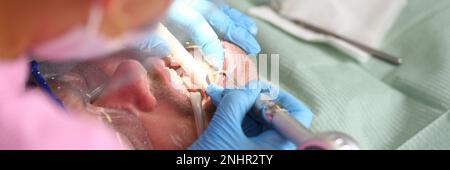 Der Patient mit Zahnarzt überprüft die Zähne und bohrt die Zähne mit Karies Stockfoto